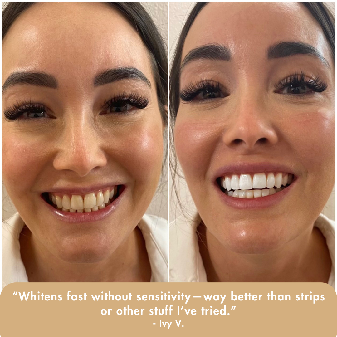 Extra-Strength Whitening Serum
