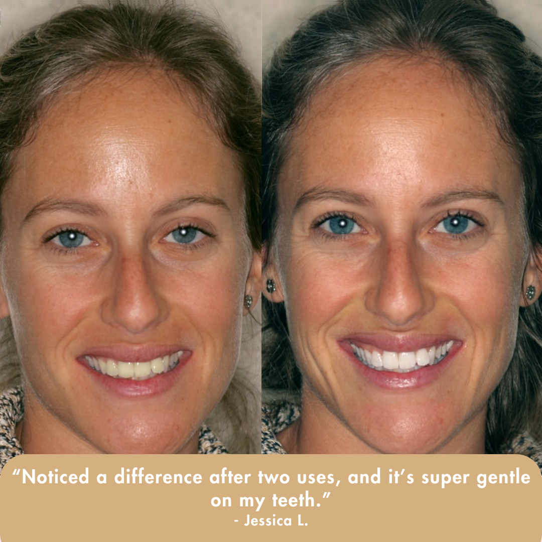 Extra-Strength Whitening Serum