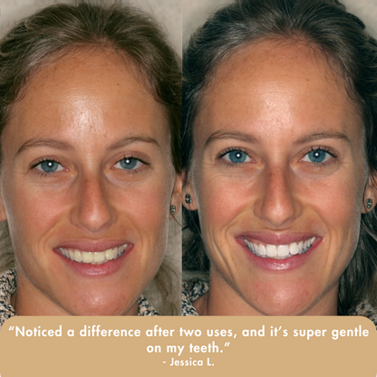 Extra-Strength Whitening Serum