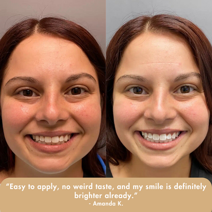 Extra-Strength Whitening Serum