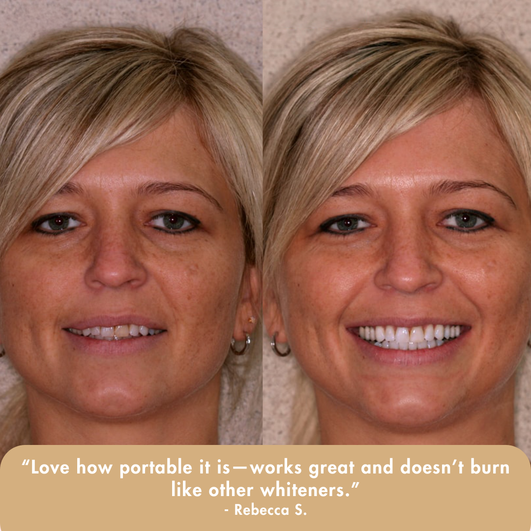 Extra-Strength Whitening Serum